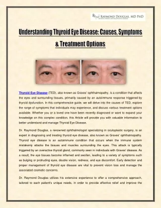 Understanding Thyroid Eye Disease - Causes, Symptoms & Treatment Options