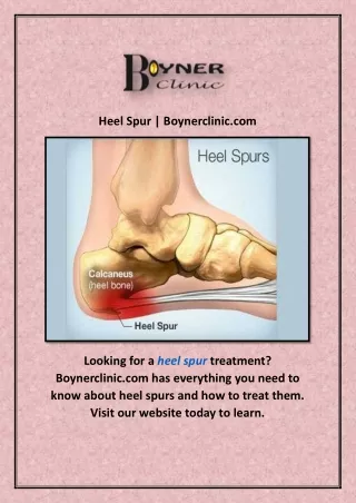 Heel Spur | Boynerclinic.com