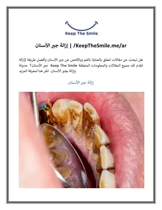 إزالة جير الأسنان | /KeepTheSmile.me/ar