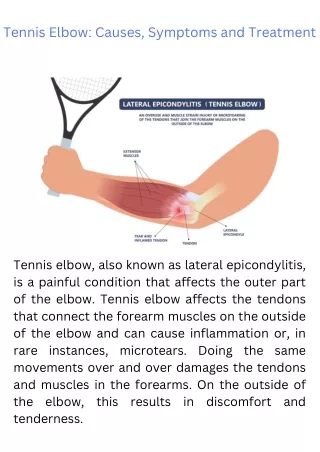 Tennis Elbow Causes, Symptoms and Treatment