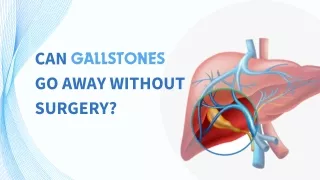 Can gallstones go away without surgery ?