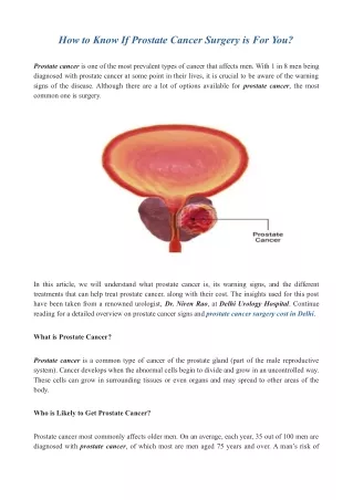 How to Know If Prostate Cancer Surgery is For You?