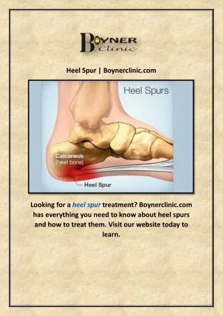 Heel Spur | Boynerclinic.com