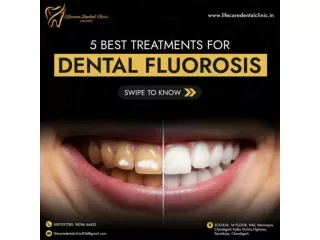 5 Best Treatments for Dental Fluorosis | Lifecare Dental Clinic