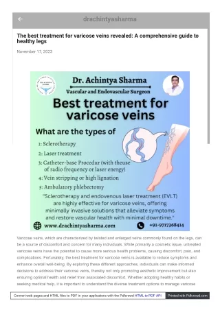 "The Best Treatment Methods for Varicose Veins A Practical Guide "