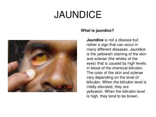 JAUNDICE