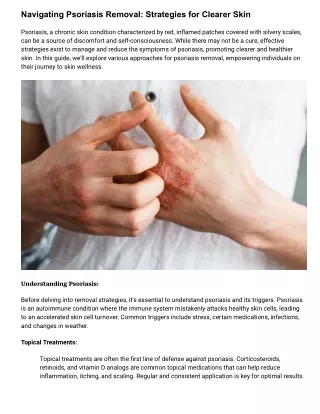 Psoriasis Treatment