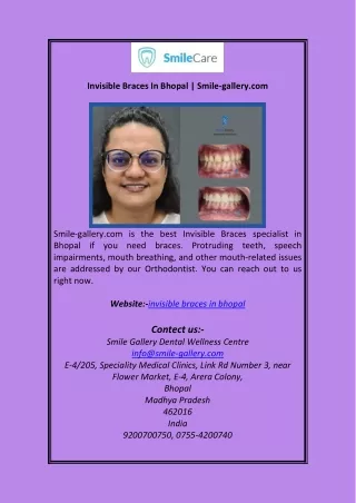 Invisible Braces In Bhopal Smile-gallery.com