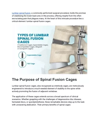 Learn All things about Lumbar Spinal Fusion Cages