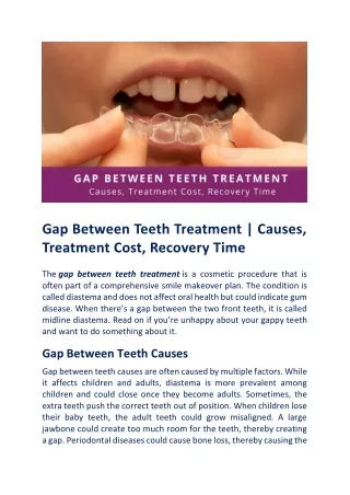 Everything You Need Gap Between Teeth Treatment