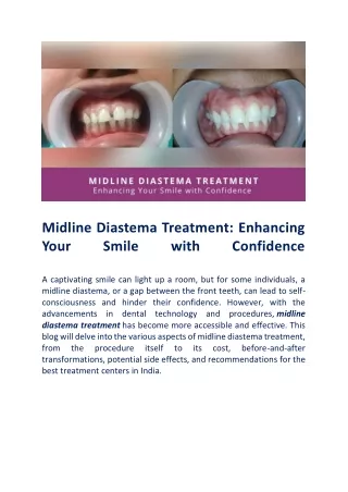 All That You Must Know About Midline Diastema Treament