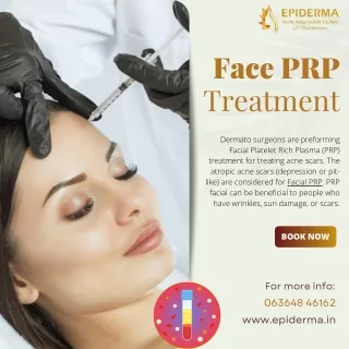 Face PRP Treatment in Jayanagar | Epiderma Skin and Hair Clinic Jayanagar