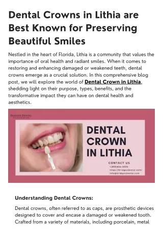 Dental Crowns in Lithia are Best Known for Preserving Beautiful Smiles