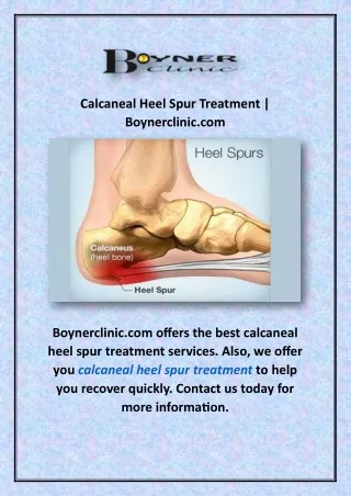 Calcaneal Heel Spur Treatment | Boynerclinic.com