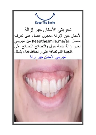 إزالة جير الأسنان تجربتي