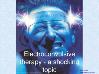 Electroconvulsive therapy - a shocking topic