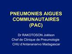 PNEUMONIES AIGUES COMMUNAUTAIRES PAC