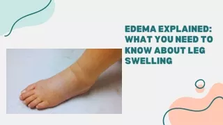 Swollen Legs Treatment in Coimbatore | Leg Swelling Specialist in Coimbatore