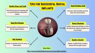 Tips for Successful Dental Implants