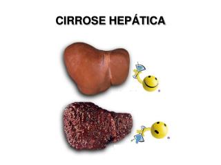 CIRROSE HEPÁTICA