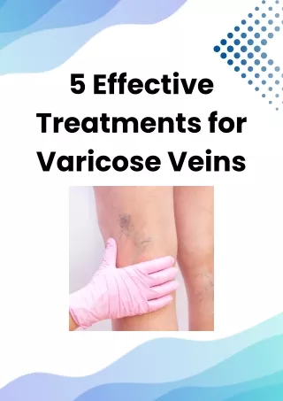 5 Effective Treatments for Varicose Veins