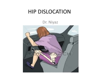 HIP DISLOCATION