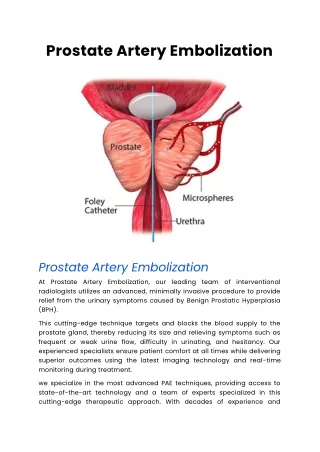 Prostate Artery Embolization