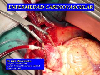 Dr. Julio Morón Castro Cirujano Cardiovascular Instituto Nacional del Corazón – INCOR Clinica San Pablo