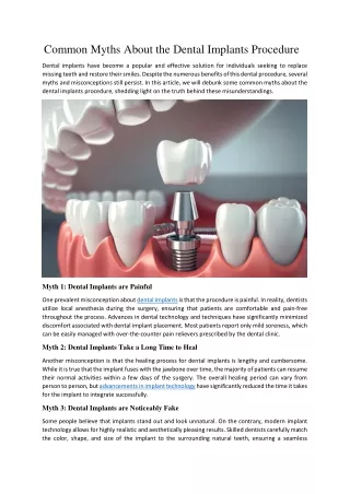 Common Myths About the Dental Implants Procedure