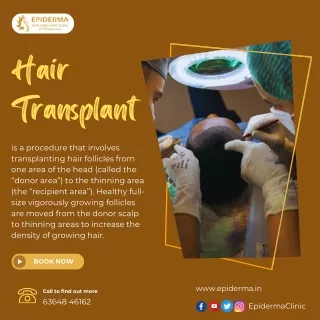 Hair Transplant | Best Hair Transplantation in Jayanagar | Epiderma Clinic