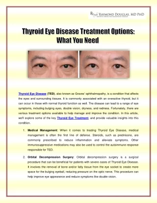 Thyroid Eye Disease Treatment Options - What You Need