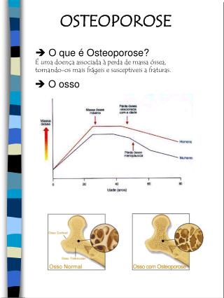 OSTEOPOROSE