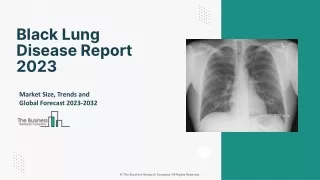 Black Lung Disease Market Size, Share, Growth Factors And Trends Report 2033