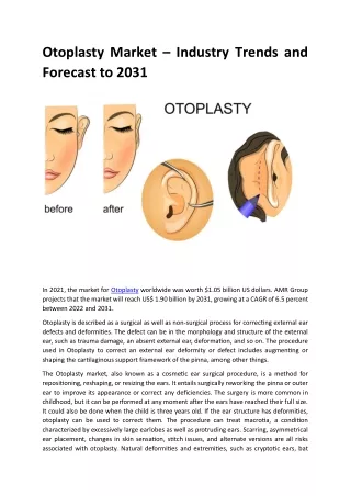 Otoplasty Market