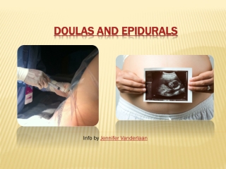 Doulas and Epidurals