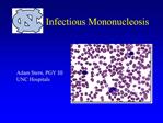 Infectious Mononucleosis Virology