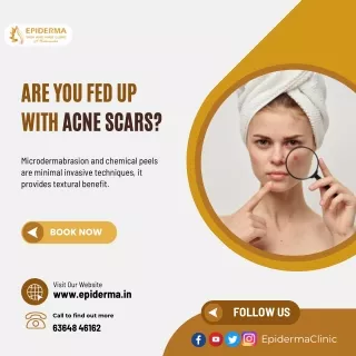 Are you fed up with acne scars? | Skin Clinic in Jayanagar | Epiderma Clinic