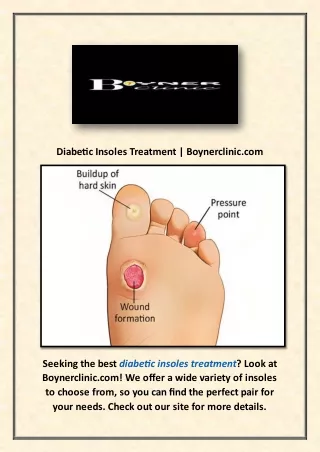 Diabetic Insoles Treatment | Boynerclinic.com