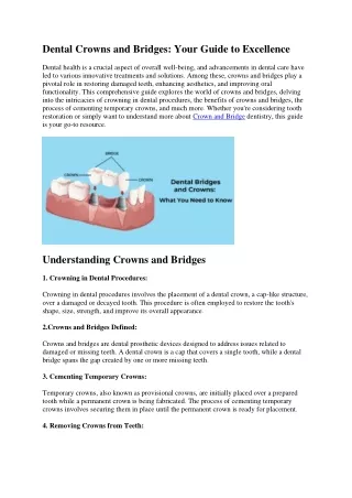 Dental Crowns and Bridges