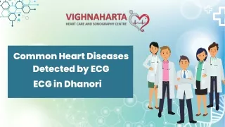 Common Heart Diseases Detected by ECG