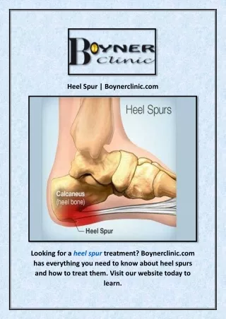 Heel Spur | Boynerclinic.com