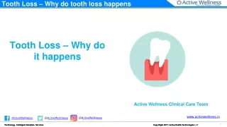 Tooth Loss – Why do tooth loss happens - Active Health