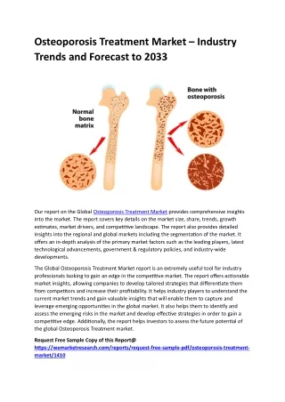 Osteoporosis Treatment Market – Industry Trends and Forecast to 2033