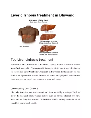 Liver cirrhosis treatment in Bhiwandi