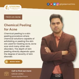 Chemical Peeling for Acne | Best Skin Clinic in Jayanagar | Epiderma Clinic