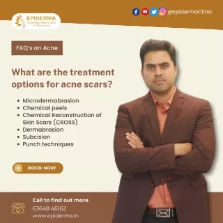 Treatment Options for acne scars | Skin Clinic in Jayanagar | Epiderma Clinic