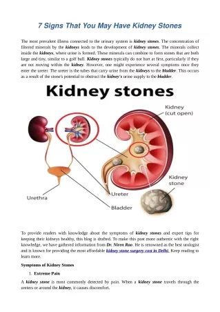 7 Signs That You May Have Kidney Stones