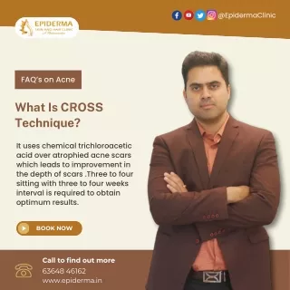 What is CROSS Technique | Skin Clinic Jayanagar | Epiderma Skin and Hair Clinic