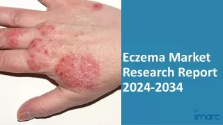 Eczema Market 2024: Epidemiology, Industry Trends, Size, Share And Forecast