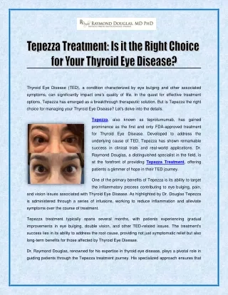 Tepezza Treatment - Is it the Right Choice for Your Thyroid Eye Disease